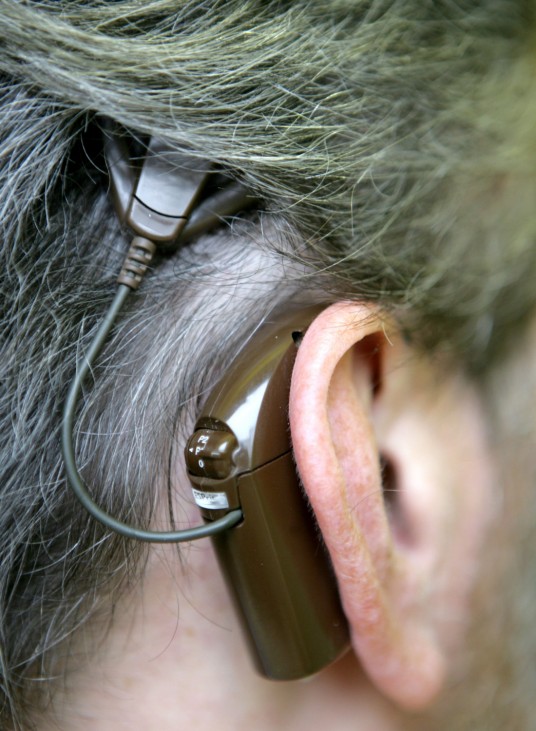 Taub sein und doch hören - Mini-Implantat hilft