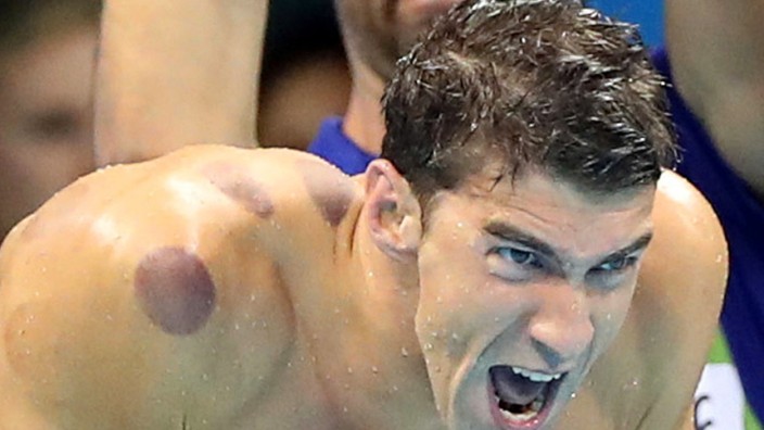 Olympia: Michael Phelps.