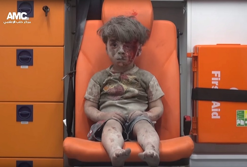 Verwundeter Junge aus Aleppo