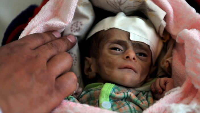 Hungerkrise im Jemen