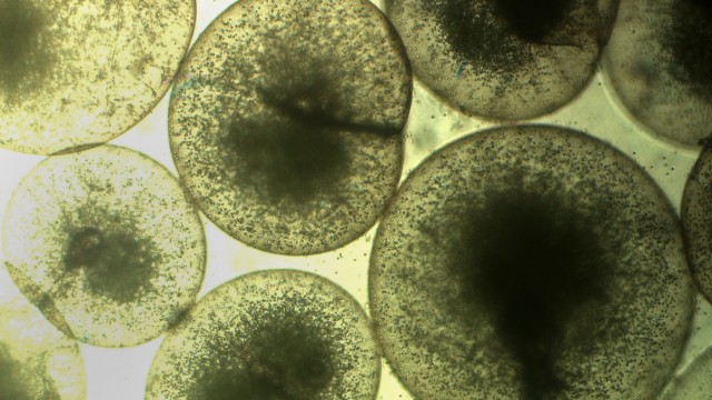 Algenblüte: Noctiluca scintillans bei 50-facher Vergrößerung unter dem Mikroskop betrachtet.