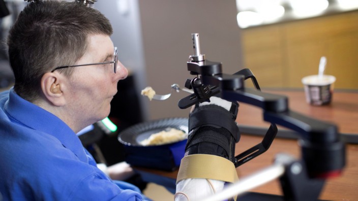 Bill Kochevar is using computer-brain interface technology and an electrical stimulation system to move his own arm after eight years of paralysis, in this undated handout photo