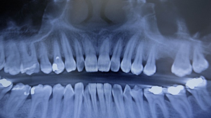 Trotz Millionenausgaben: Gesunde Zähne, also nicht solche wie im Bild zu sehen, sind wichtig - ein Leben lang.