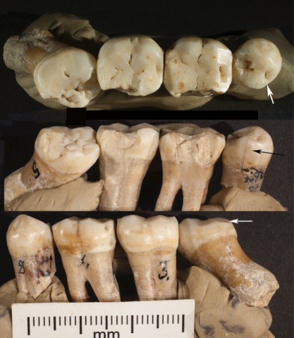 Neandertaler Zähne