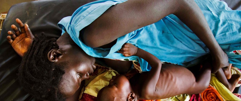 Welthunger-Index: Eine Frau stillt in einem Hilfslager der Ärzte ohne Grenzen in Südsudan ihr schwer unterernährtes Kind