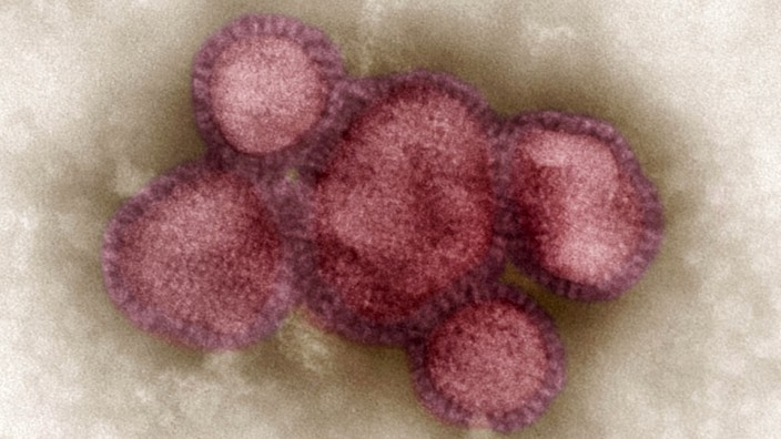 Influenza-A-Viren