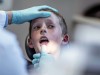 Sind Zahnspangen immer notwendig?
