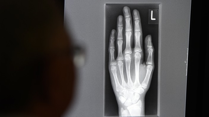 Röntgenbild einer jugendlichen Hand