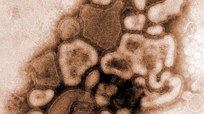 Das Virus: Das Virus unter dem Elektronenmikroskop.