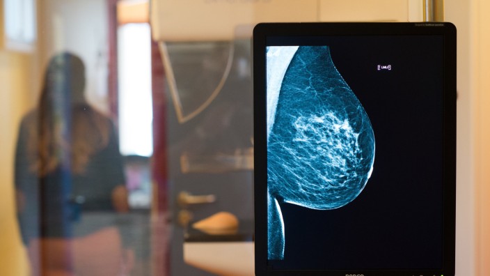 Brustkrebs: Diese Röntgenaufnahme, die als Teil in einem Trailer des Mammographie-Screening-Programms aufgenommen worden ist, zeigt eine gesunde Brust.