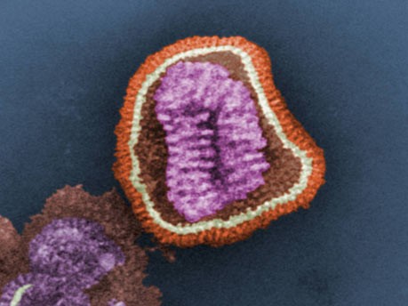 Influenza-Erregers des Typs H1N1