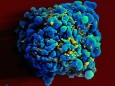 Mit HIV infizierte H9 T-Zelle