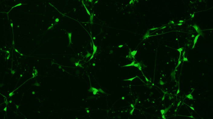 Design: Stammzellen lassen sich im Labor zu Nervenzellen heranzüchten - eine Anregung für die Kunst?
