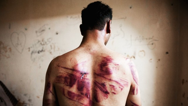 Kriegsverbrechen: Wunden der Folter: Nur ein Opfer der Gewalt durch syrische Regierungstruppen.