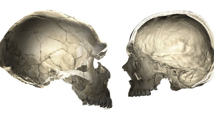 Human Versus Neandertal Braincase