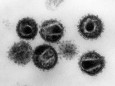 HIV und Aids - HI-Viren unter dem Mikroskop