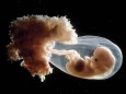 Biologie et grossesse chez la femme poche amniotique contenant un embryon humain puis foetus a l