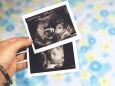 Woman hands holding two baby girl ultrasounds 4D ultrasound model released Symbolfoto property rele