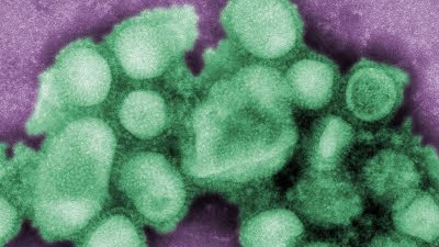 Schweinegrippe: Der Schweinegrippen-Erreger N1N1 breitet sich auf der Welt aus - und sorgt für Beunruhigung.