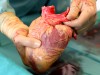 Organspende: Mediziner hält Herz in der Hand