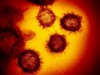 Coronavirus - USA