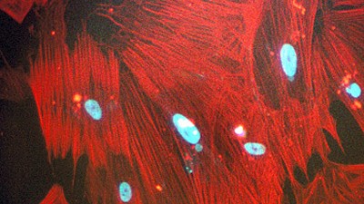 Stammzellen-Forschung: Stammzellen aus Körperzellen: Menschliche iPS-Zellen unter dem Mikroskop.