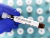 Laborarzt hält ein Reagenzglas mit positivem Ergebnis des Coronavirus-Tests in der Hand, im Hintergrund viele Blutröhrc