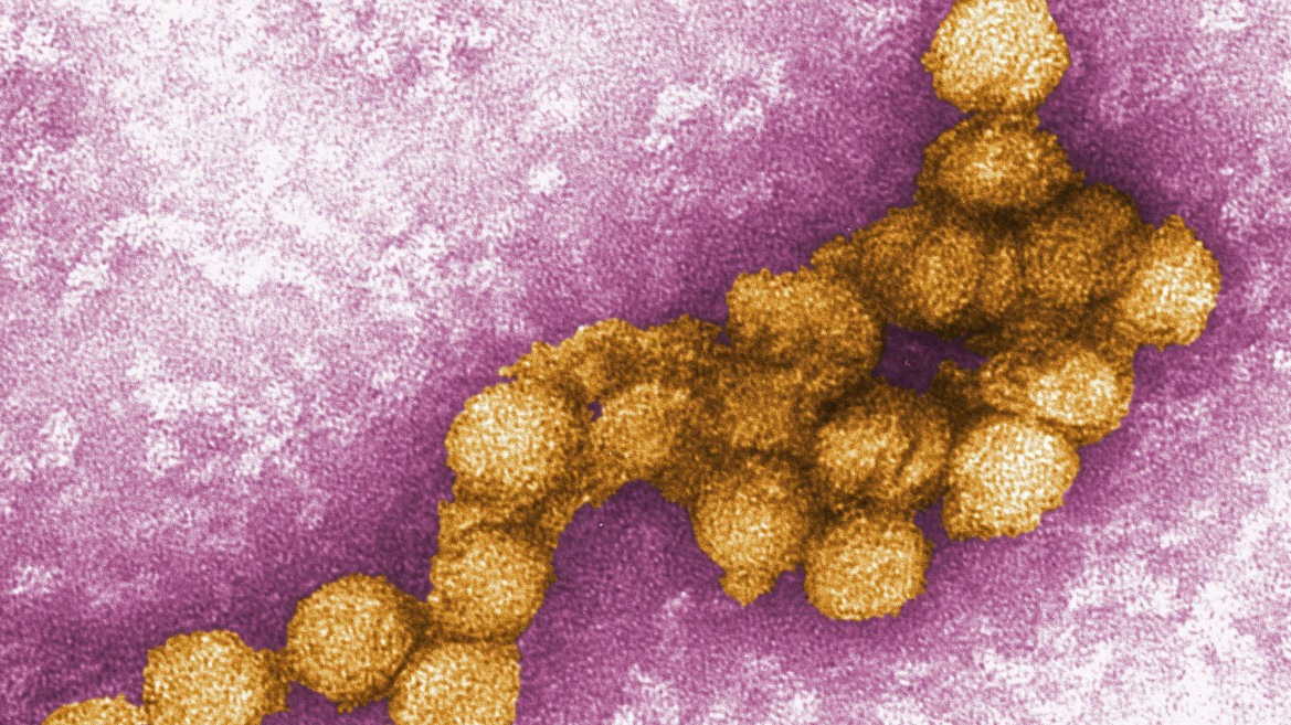 Photo of West-Nil-Virus verbreitet sich in Deutschland – Gesundheit