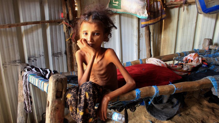 Jemen: Hungersnot in Jemen: Die zehnjährige Ahmadia Abdo wiegt auf diesem Bild vom 23. Januar zehn Kilogramm.
