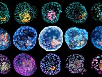 Medizin: Biologen erzeugen menschliche Embryomodelle im Labor