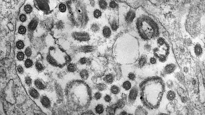 Marburg-Virus unter dem Elektronenmikroskop