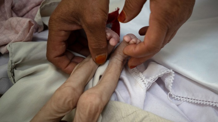Afghanistan: Die Beine eines unterernährten vierjährigen Jungen in Kabul. Die Lage ist katastrophal.
