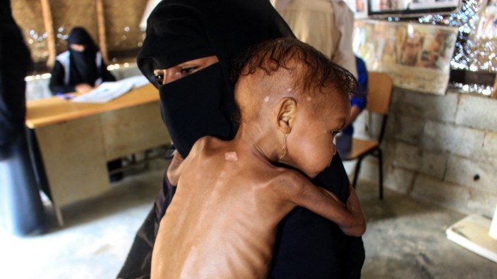 Krieg: In Jemen sind zwei Drittel der Bevölkerung auf Hilfslieferungen angewiesen, viele Kinder sind unterernährt.