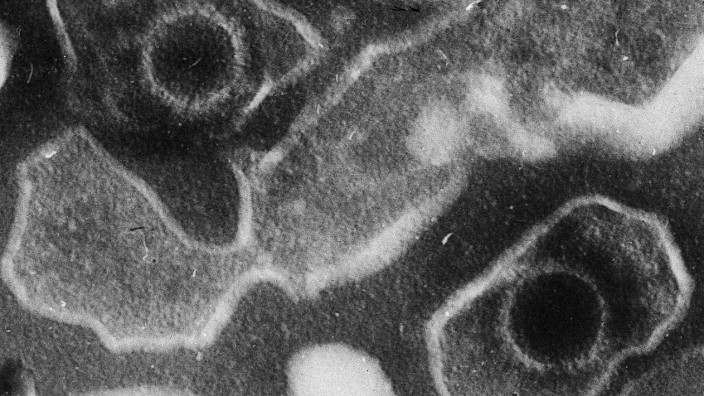 Medizin: Das Epstein-Barr-Virus unter dem Elektronenmikroskop: kugelförmige Viruspartikel umgeben von einer Membran.