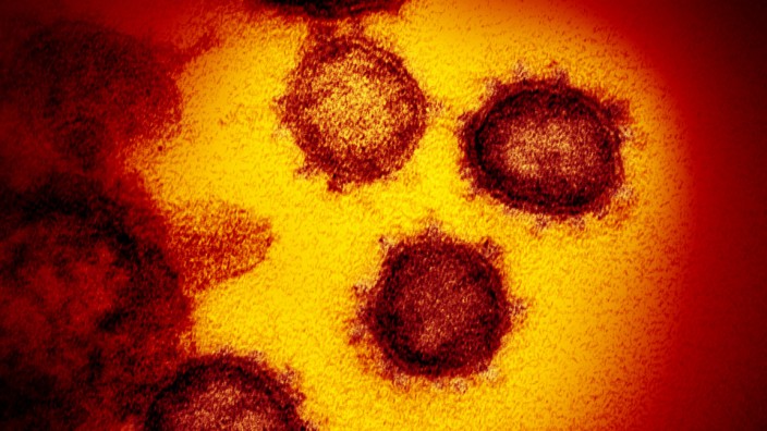 Seuchen: Das Coronavirus SARS-CoV-2 unter dem Elektronenmikroskop. Wo die Pandemie ihren Anfang nahm, ist immer noch umstritten.