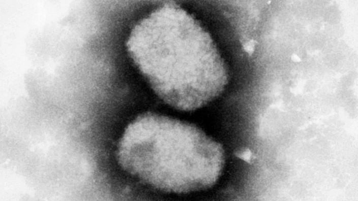 Virus: Diese vom Robert-Koch-Institut (RKI) zur Verfügung gestellte elektronenmikroskopische Aufnahme zeigt das Affenpockenvirus.