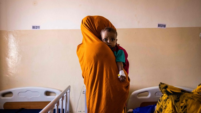 Hungerkrise: In Somalia leiden Menschen seit Jahren Hunger - wie dieses Kind in einem Krankenhaus in Mogadischu. Nun bleiben auch noch Getreidelieferungen aus der Ukraine aus.