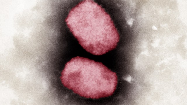Virologie: Ingekleurde elektronenmicrofoto van het apenpokkenvirus.