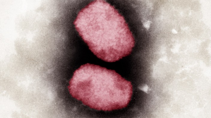 Affenpocken-Viren unter dem Elektronen-Mikroskop