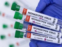 Infektionskrankheiten: WHO stuft Affenpocken nicht als Notfall ein – vorerst