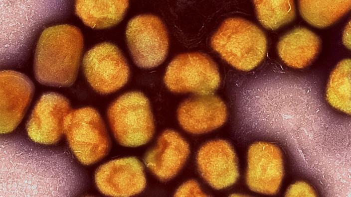 Infektionskrankheiten: Eine golden eingefärbte Aufnahme von Partikeln des Affenpockenvirus. Der Erreger breitet sich im Moment in Europa aus.