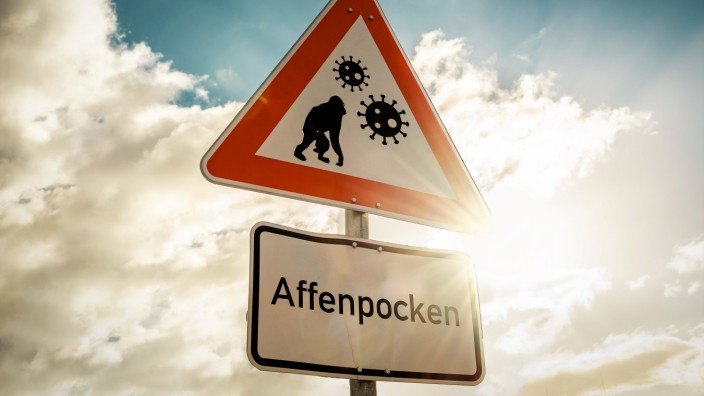 Landkreis Ebersberg: Im Juli wurde im Landkreis Ebersberg der erste und bisher einzige Fall von Affenpocken registriert.