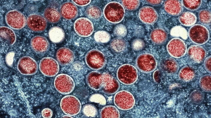 Infektionskrankheiten: Noch immer präsent: eine kolorierte Aufnahme von Affenpocken-Viruspartikeln (rot) im Elektronenmikroskop.
