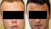 Dritter Tag im U-Bahn-Schläger-Prozess: Der 18-jährige Spyridon L. (links) und der 21-jährige Serkan A. (rechts) stehen seit Montag im U-Bahn-Schläger-Prozess in München vor Gericht.