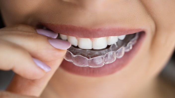 Zahnschienen: Etwa 13 Prozent der Erwachsenen leiden nachts an Bruxismus, bei Kindern gehen die Schätzungen weit auseinander: Die Rede ist von 2,5 bis 50 Prozent.