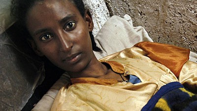 Weltseuche Aids: HIV-infiziertes Mädchen im ostafrikanischen Äthiopien. Die Aufnahme entstand im Jahre 2005