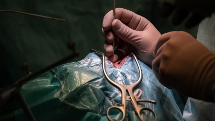 Medizinischer Dienst: Ein Arzt operiert während einer Operation in der Neurochirurgie am offenen Schädel eines Patienten. Der Medizinische Dienst hat am Donnerstag seine Jahresstatistik 2022 zur Begutachtung von Behandlungsfehlern vorgestellt.