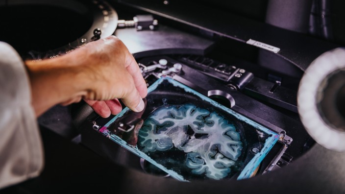 Neurowissenschaft: Trotz Supercomputer unerlässlich: Ein Spezialmikroskop hilft bei der Analyse eines Hirnschnittes im Labor.