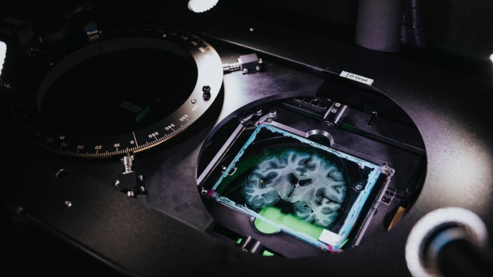 Human Brain Project: Das Gehirn birgt noch viele Geheimnisse, die auch Grundlagenforscher nicht so bald enträtseln werden.