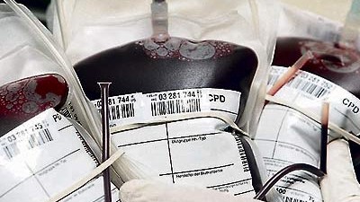 HIV-verseuchte Blutkonserven: undefined